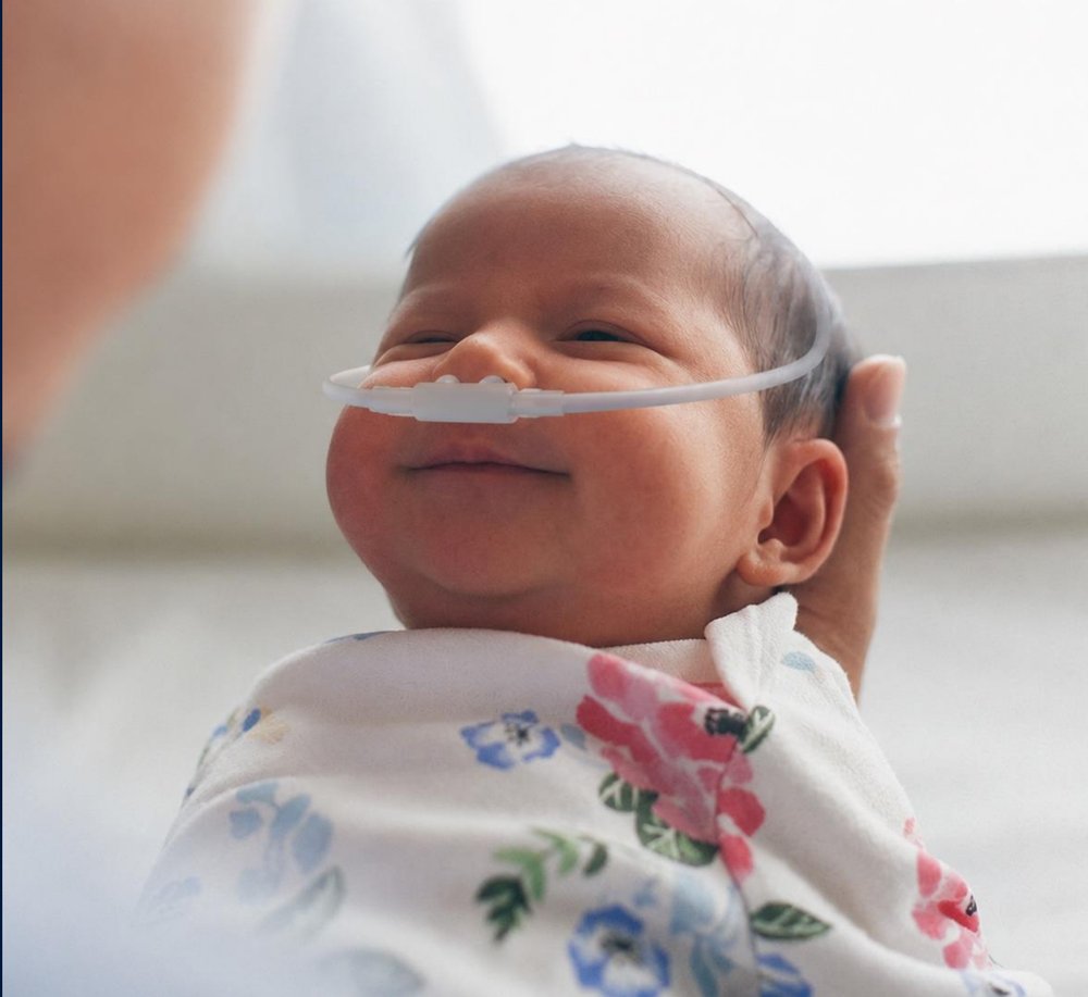 A smiling infant receiving respiratory support
